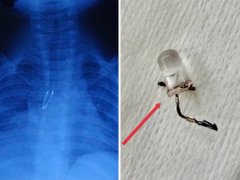 Đọc nhanh bài viết 1037272