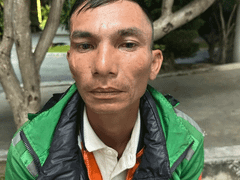Đọc nhanh bài viết 1172421