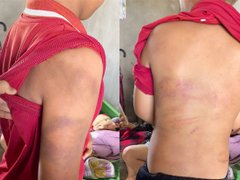 Đọc nhanh bài viết 1182055