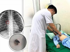 Đọc nhanh bài viết 1182350