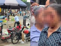 Đọc nhanh bài viết 1183626
