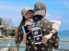 Đọc nhanh bài viết 1183925