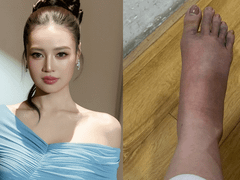 Đọc nhanh bài viết 1189244