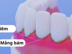 Đọc nhanh bài viết 1191113