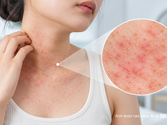 Đọc nhanh bài viết 1192059