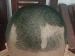 Đọc nhanh bài viết 1192611