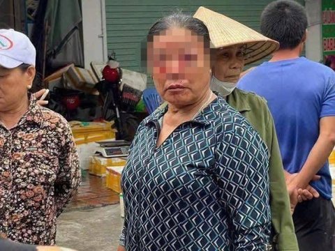 Ảnh bài viết