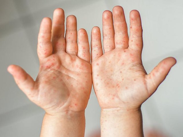 Đọc nhanh bài viết #1035900