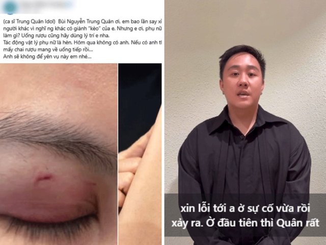 Đọc nhanh bài viết #1036806