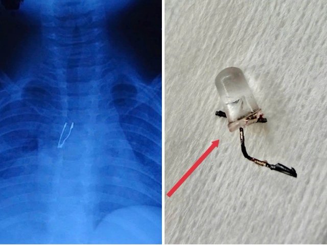 Đọc nhanh bài viết #1037272