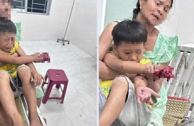 Đọc nhanh bài viết #1037455