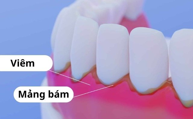 Đọc nhanh bài viết #1191113